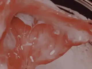 Heart Sounds (mostly silent, 1950s?)