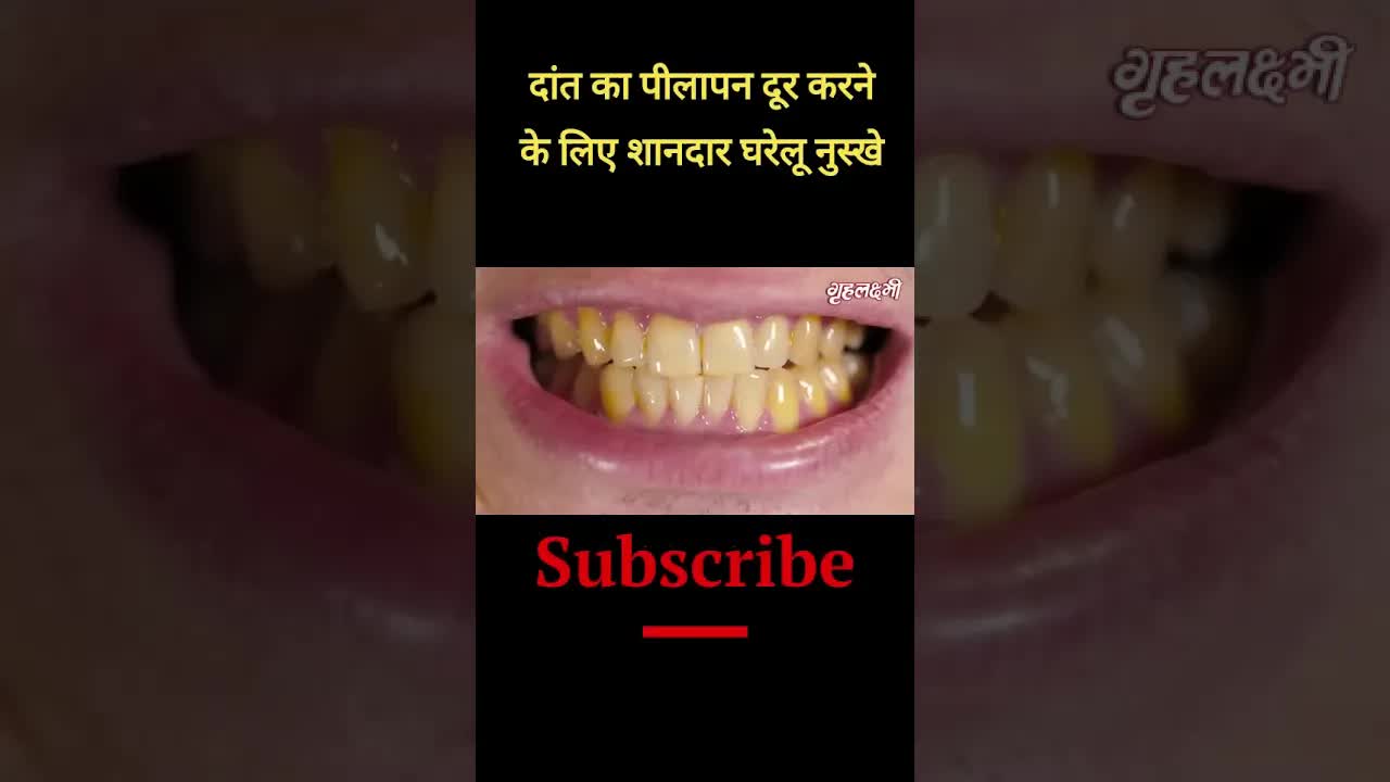 Yellow Teeth cleaning at Home | Tips for Yellow teeth | दांत का पीलापन हटाने के घरेलु नुस्खे #shorts