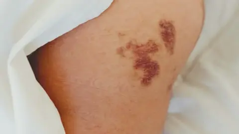 Tailored anti-aging by life stage